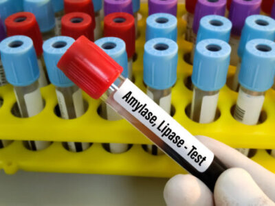 альфа-амілаза